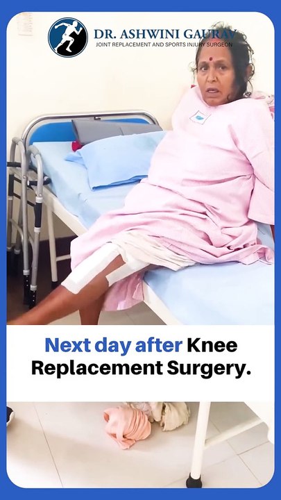 Successful Knee Replacement Surgery