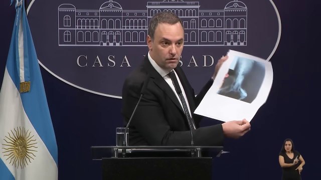 El Gobierno volvió a utilizar la receta de la auditoría que encuentra graves hechos de corrupción para recortar derechos