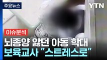 [뉴스퀘어 2PM] 뇌종양 3세 때리고 밀쳐...보육교사 