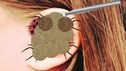 ASMR Treatment Ear || Animation Treatment