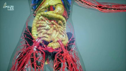 Study Finds Microplastics in Most Samples of Arterial Plaque Clogging Cardiovascular System