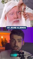 Ce jeune albinos voulait devenir brun