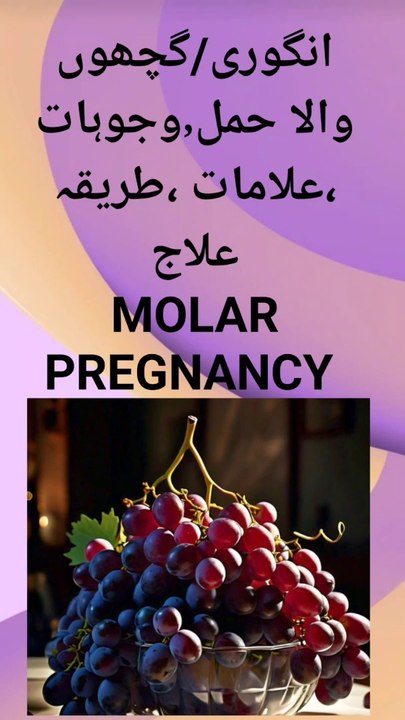 Molar Pregnancy/Angoori Hamal/ انگوری حمل