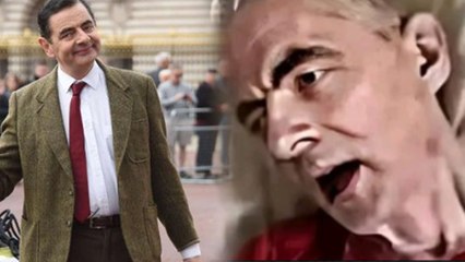 Mr. Bean Rowan Atkinson Bed Ridden Sick Photo Viral, Fact Check..| Boldsky
