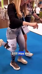 "Revolutionary Prosthetic Foot for Enhanced Mobility"