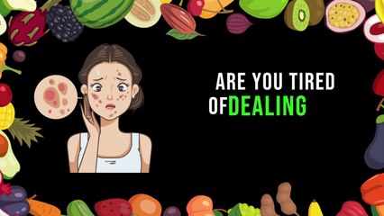 17 Drinks For Acne-Free Skin - Best Drinks For Acne Free Skin- Wellnest