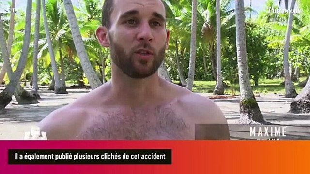 Koh-Lanta : Un candidat emblématique perd une partie de ses doigts, une greffe impossible et des images impressionnantes