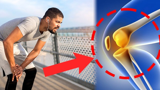 Myths Vs Facts: Excessive Running से Knee Damage Risk | Daily Running Karne Se Kya Hota Hai