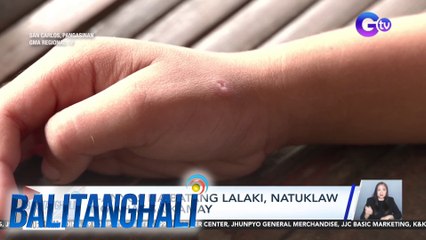 5-anyos na batang lalaki, natuklaw ng ahas sa kamay | Balitanghali