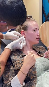 Anti-Tragus: The New Ear Lobe Trend #earpiercing #traguspiercing #antitraguspiercing #nosepiercing