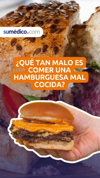 ¿Qué tan malo es comer una hamburguesa mal cocida?
