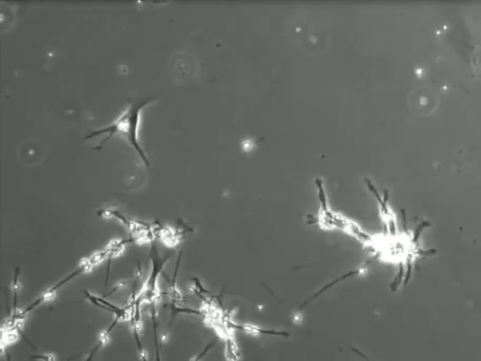 connexions neurones Brain Cells Making Connections