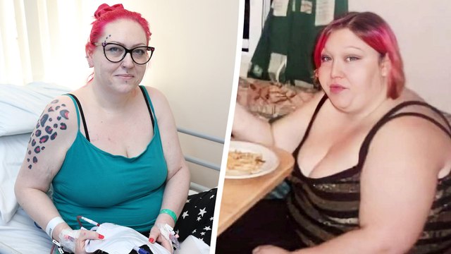 Woman with concrete” organs after botched weight loss op has new stomach built