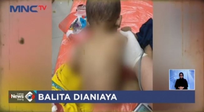 Dua Balita Dianiaya Orang Tua Asuh di Cilincing, Jakarta Utara