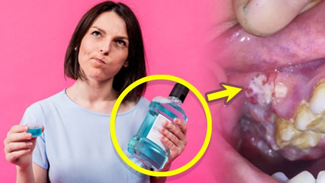 Mouthwash Karne Se Kya Hota Hai | Does Mouthwash Cause Cancer, FACT CHECK...|Boldsky