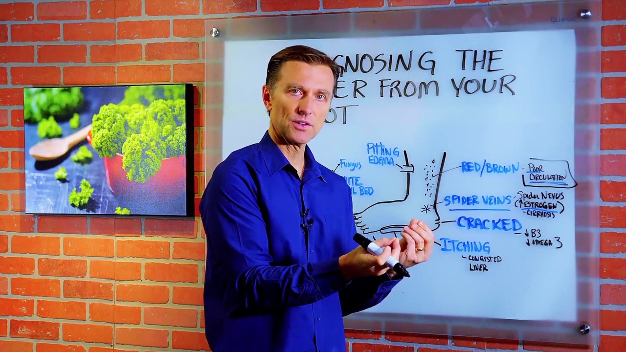 How Your Feet Are Warning You About Your Liver Problems - Dr. Berg Explains