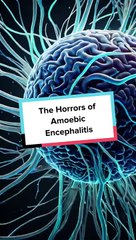The Horrors of Amoebic Encephalitis