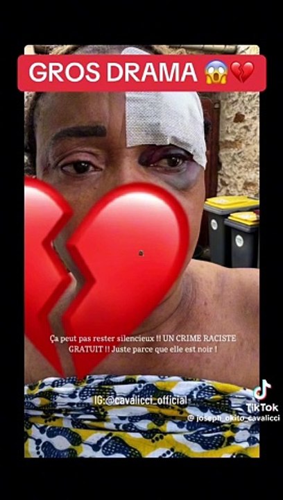 Agression raciste : Barabas de Toofan fait face à une tragédie familiale (VIDEO)