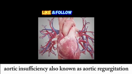 Aortic Insufficiency Causes, Symptoms, Diagnosis,