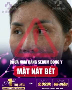 #213 Lệ ADS 82023-2.8-13-h01 finalll