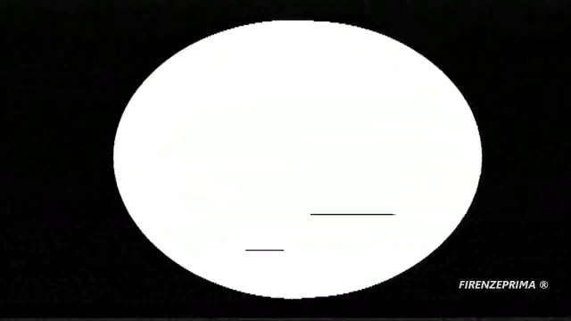 Cateterismo cardiaco Prof. Finocchio e Prof. Zazzo. 1969 Ampex VR 7003