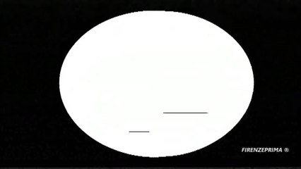 Cateterismo cardiaco Prof. Finocchio e Prof. Zazzo. 1969 Ampex VR 7003