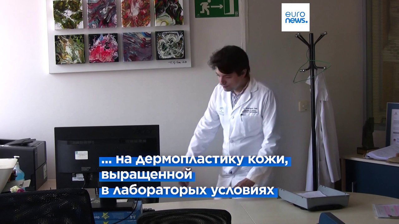 В Испании начали применять кожу из пробирки для...