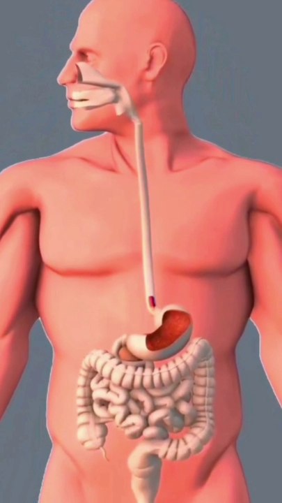 Capsule Endoscopy कैप्सूल एंडोस्कोपी تنظير الكبسولة Kapsül Endoskopi   Capsule Endoscopy Explained  Pill Cam Journey  Small Bowel Secrets Revealed  Gastro Health Check  Endoscope Exam Guide  Capsule Procedure Simplified