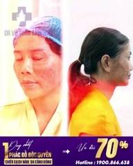 #233 CĐ Xấu đẹp, mẫu cuối t7 - 06.08 - 50 - H04