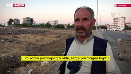 Başıboş köpeğin saldırdığı kişi parmağını kaybetme riski yaşıyor