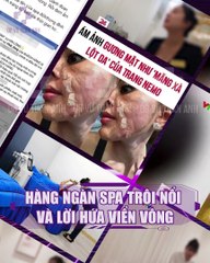 #224 CĐ Cảnh báo kem trộn - voice bác sĩ - 5.08 - 43 - H05