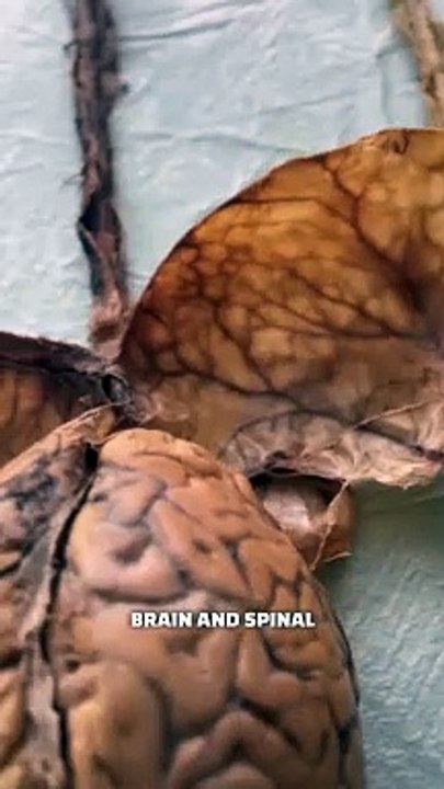 The Human Nervous System!     #brain #spinalcord #humanbody #anatomy #science #teacher #education