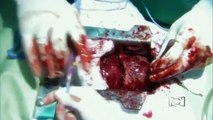 A corazon abierto 1ª Temp Capitulo 42