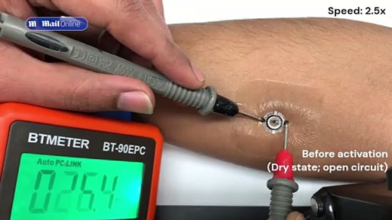 Smart bandage heals injuries 30% faster than standard dressings