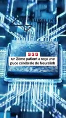  Un deuxième patient a reçu une puce cérébrale de Neuralink