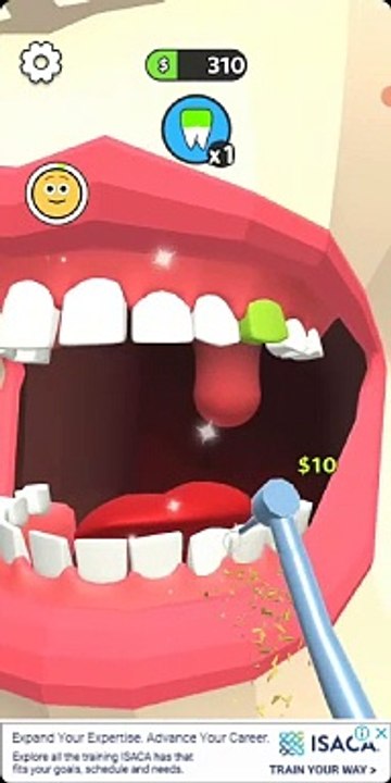 cleaning teeth from a dentist