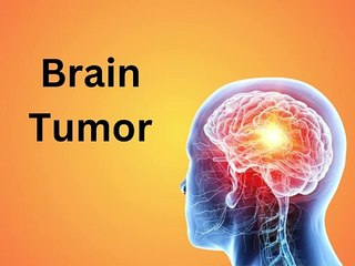 brain tumor and brain cancer in hindi | ब्रेन ट्यूमर और ब्रेन कैंसर की पूरी जानकारी हिंदी में |