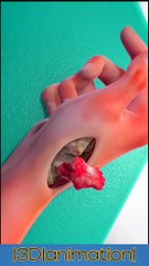 Basel joint surgery |बेसल संयुक्त सर्जरी |جراحة بازل المشتركة |Hand surgery #viral #shorts #short #DrSadia1446