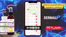 اراء بعض زبنائنا الكرام بعد استعمال ديرماليكس وكوليترون