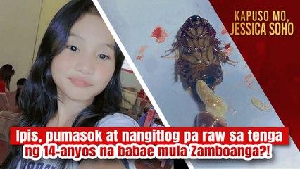 Ipis, pumasok at nangitlog pa raw sa tenga ng 14-anyos na babae?! | Kapuso Mo, Jessica Soho