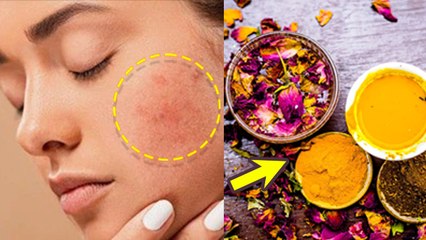 Chehra Lal Ho Jaye To Kya Kare| Skin Redness Treatment Home Remedies |Boldsky