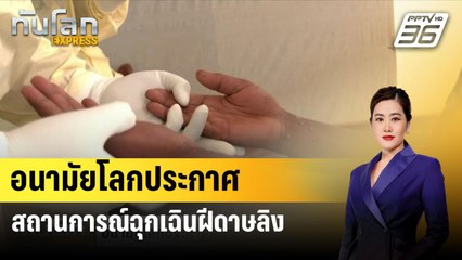 อนามัยโลกประกาศสถานการณ์ฉุกเฉินฝีดาษลิง| ทันโลกEXPRESS | 15 ส.ค. 67