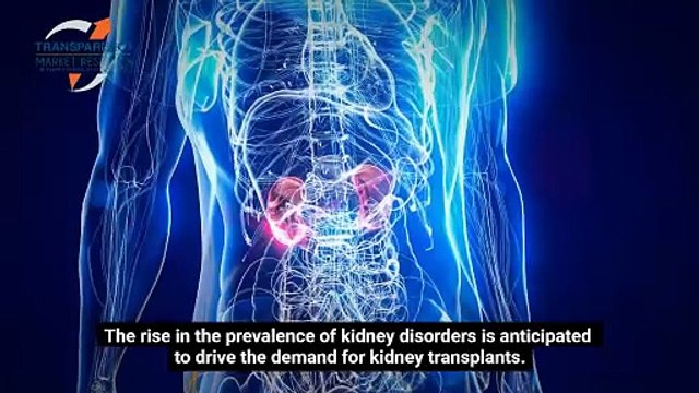 Kidney Transplant Market Outlook 2034: Growth Projections, Trends, and Key Insights