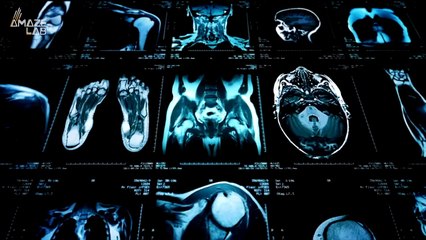 This Crazy New Tech Can Actually Look at the Brain & Heart at the Same Time!