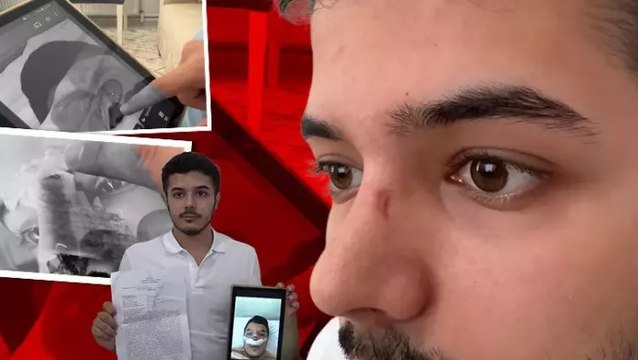 Burun ameliyatı sonrası kalıcı yara oluştuğu gerekçesiyle şikayetçi oldular