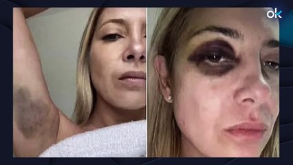 Ayuso sobre el kirchnerista Fernández acusado de maltrato: "¿A qué hora se manifiestan las feministas?"