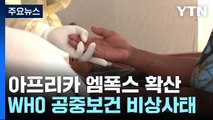 엠폭스 '공중보건 비상사태' 재선언...