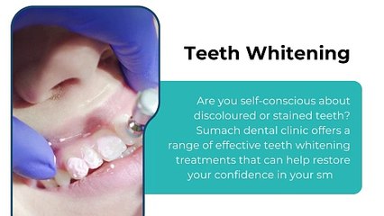 Emergency Dental Implant & Cosmetic Dentistry Services Toronto