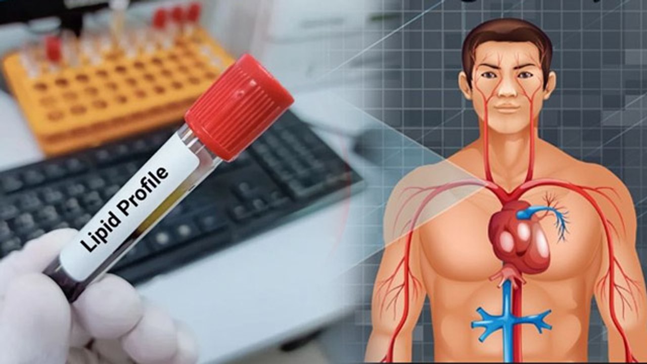 Cholesterol Level Test किस Age में कराना चाहिए | Lipid Profile Test Kab Karna Chahiye | Boldsky