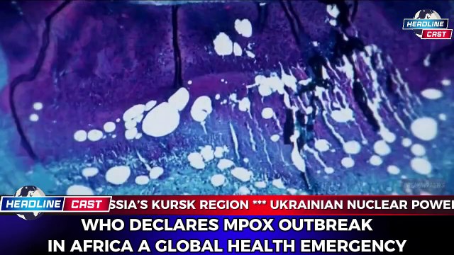 WHO Declares Mpox Outbreak in Africa a Global Health Emergency